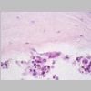 Medula osea HE 13.jpg